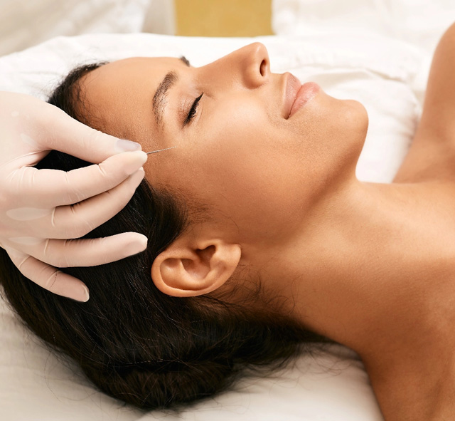 Tcm acupuncture thumbnail