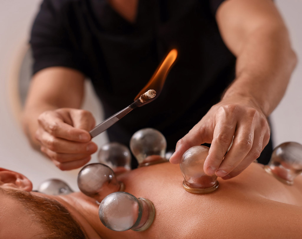 Fire cupping thumbnail